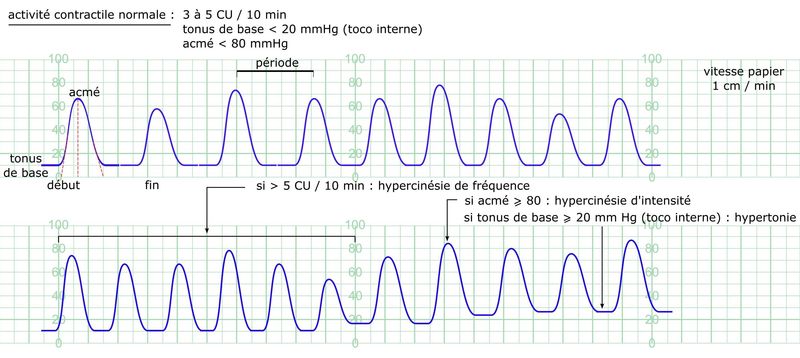 L’activité contractile (2)