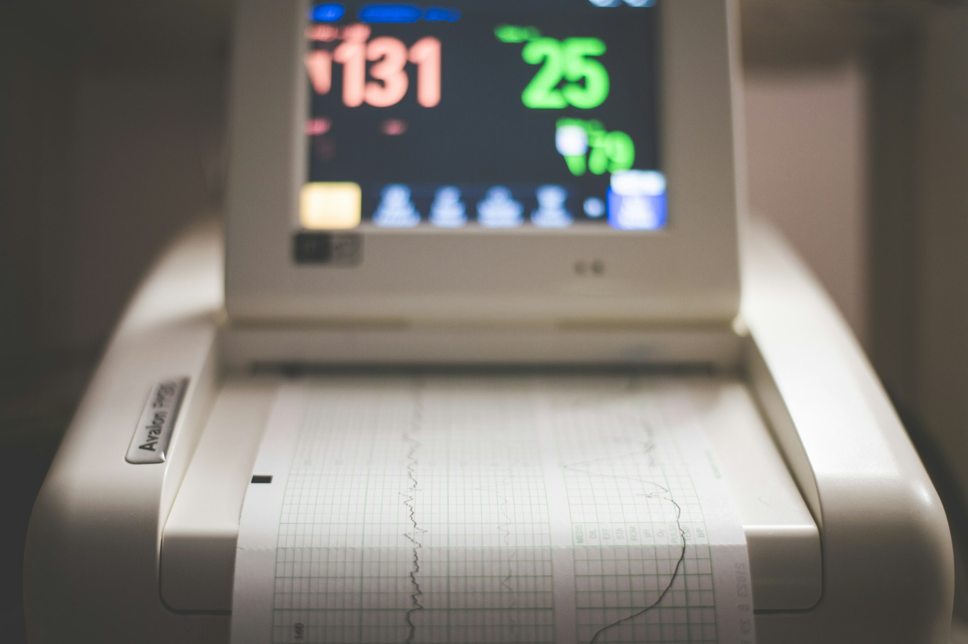 © Stephen Andrews / Unsplash (Unsplash License) Fetal monitor recording a CTG trace on paper