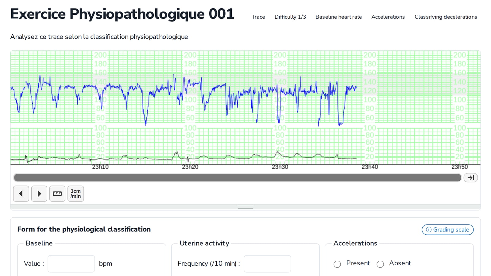 © eRCF eRCF trace analysis exercise: CTG viewer and physiological analysis grid