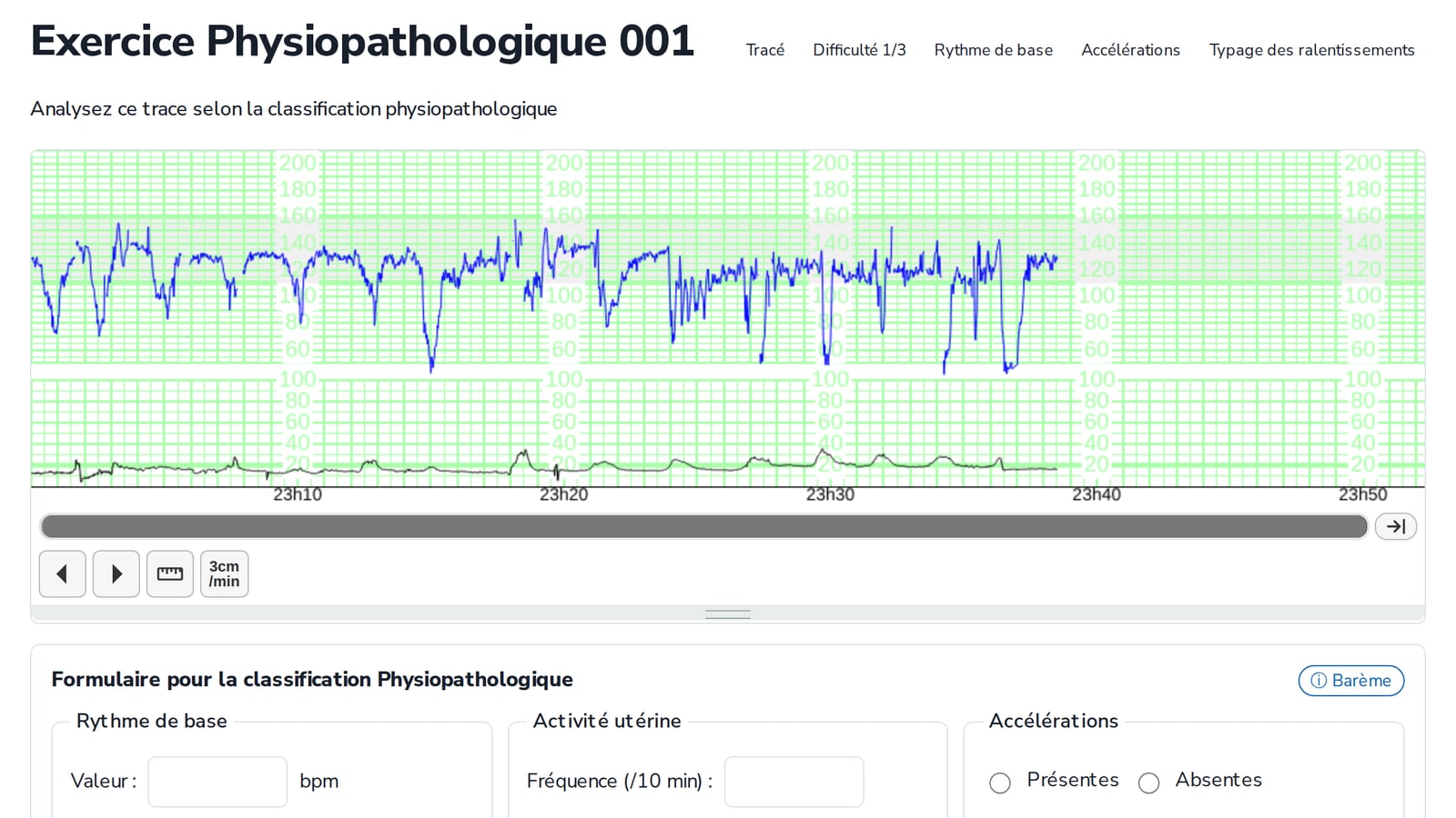 Exercice d’analyse de tracé eRCF : visualiseur RCF et grille d’analyse physiopathologique